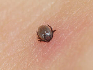 identifying bug bites and how to treat them
